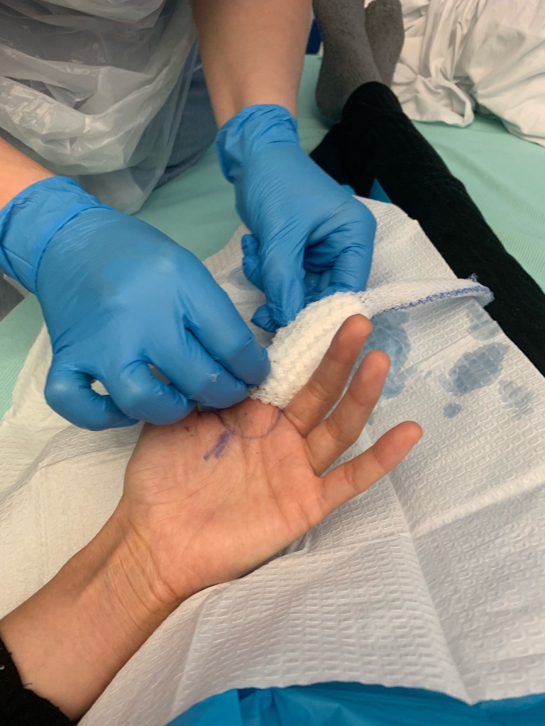 An injured finger post surgery being dressed on a hospital ward
